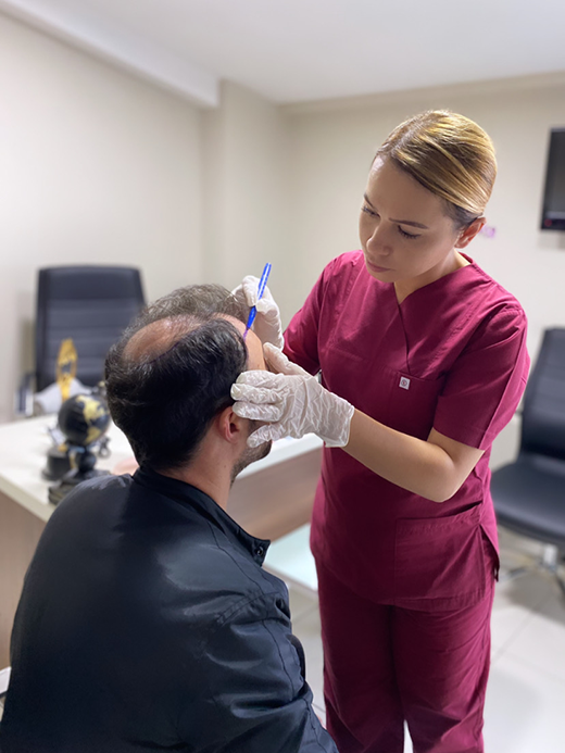 best hair transplant in Turkey