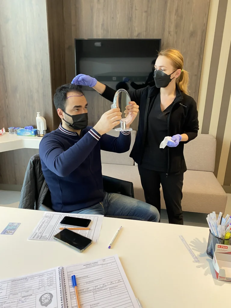 Saç ekimi öncesi sonrası
