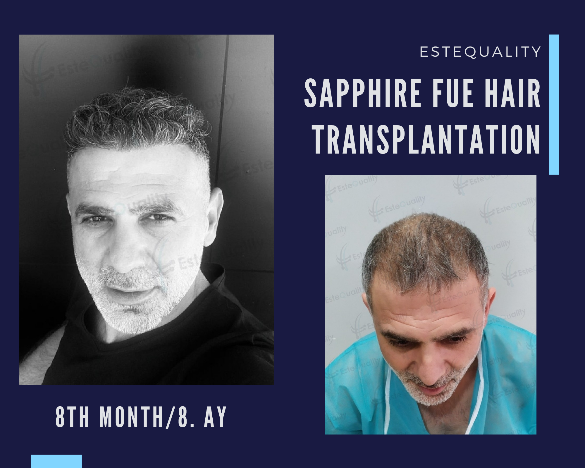 David Markovic before and after comparison