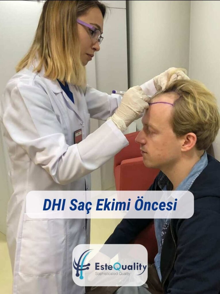 DHI Saç Ekimi Öncesi