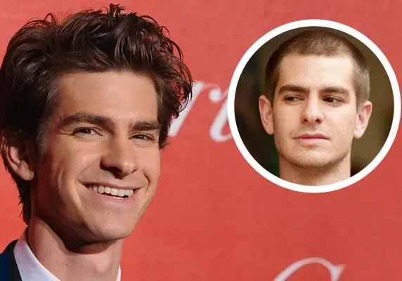 andrew garfield hair transplant
