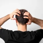 Learn how DHT causes hair loss and explore 2026’s top evidence-based treatments, from topical blockers to permanent hair transplants at Estequality.