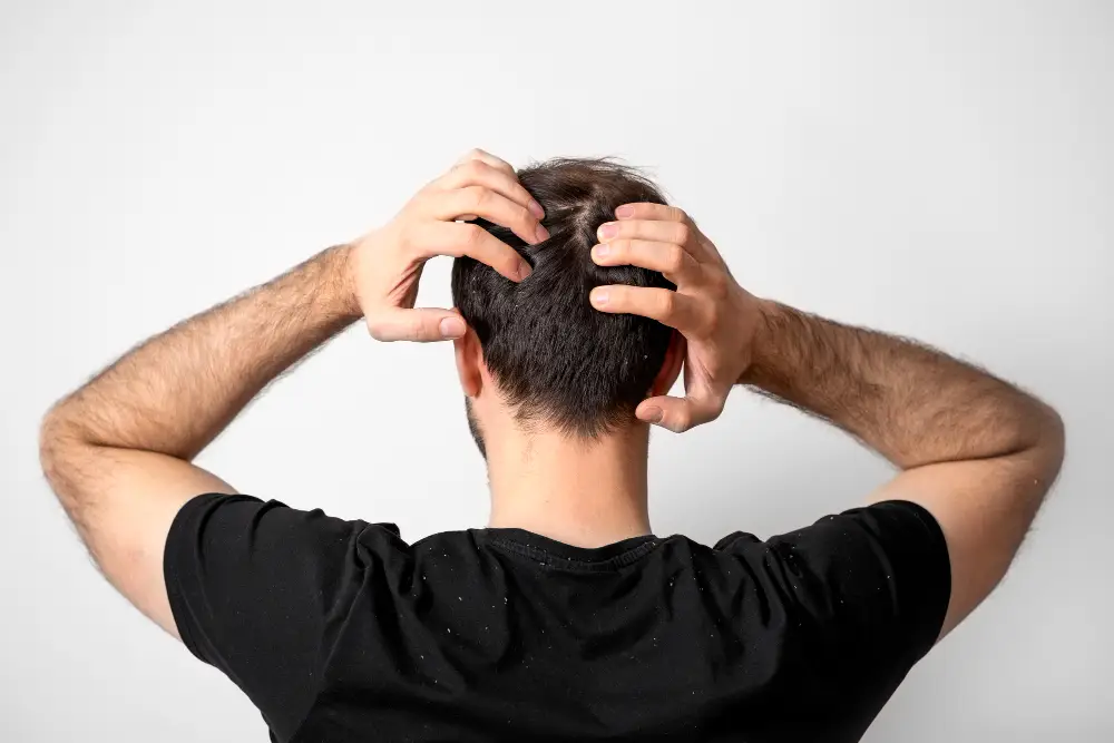 Learn how DHT causes hair loss and explore 2026’s top evidence-based treatments, from topical blockers to permanent hair transplants at Estequality.