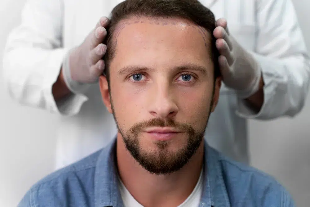 Hair transplant is not covered by insurance. Learn why, how much it costs without coverage, and why Turkey offers affordable all-inclusive hair transplant packages.