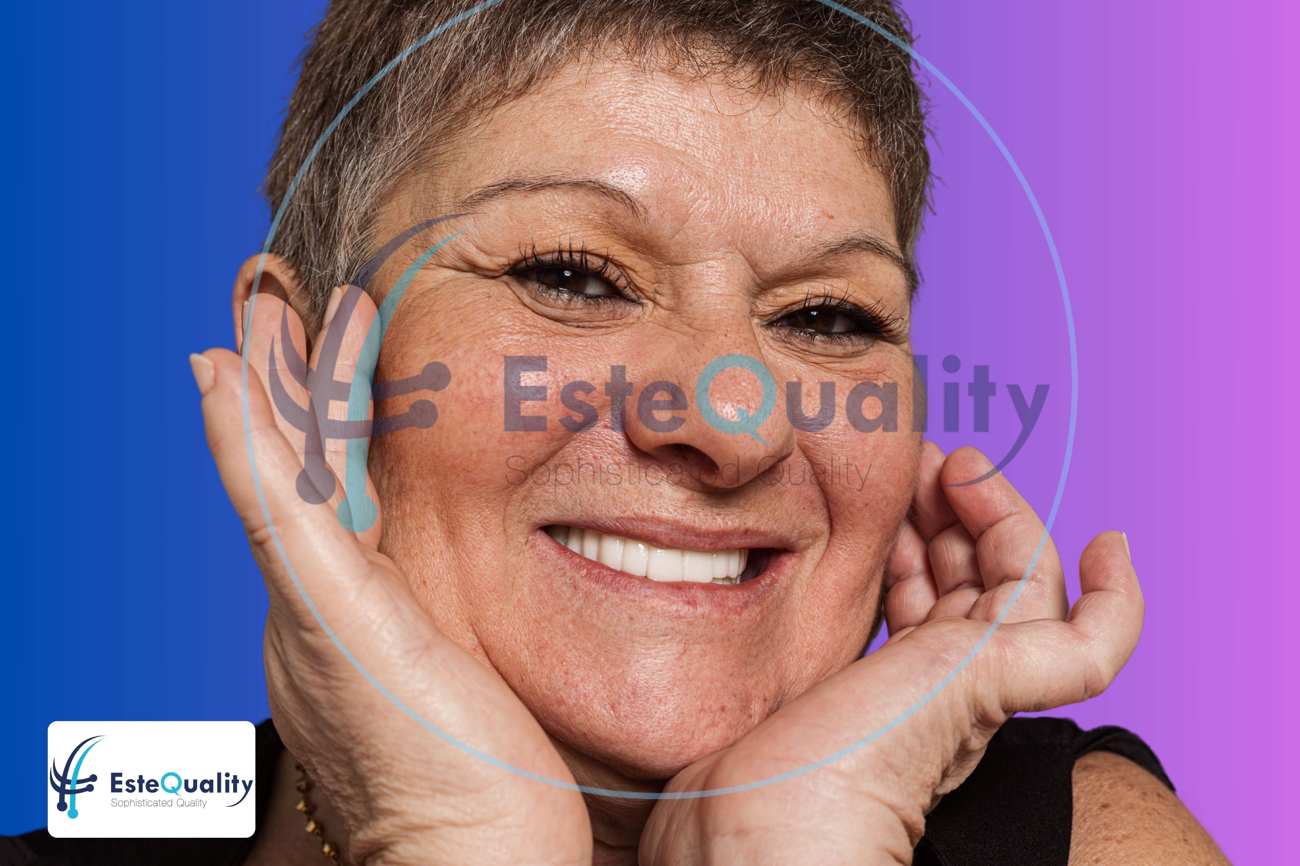 Patientin lächelt nach einer kosmetischen Zahnbehandlung in der Türkei bei EsteQuality