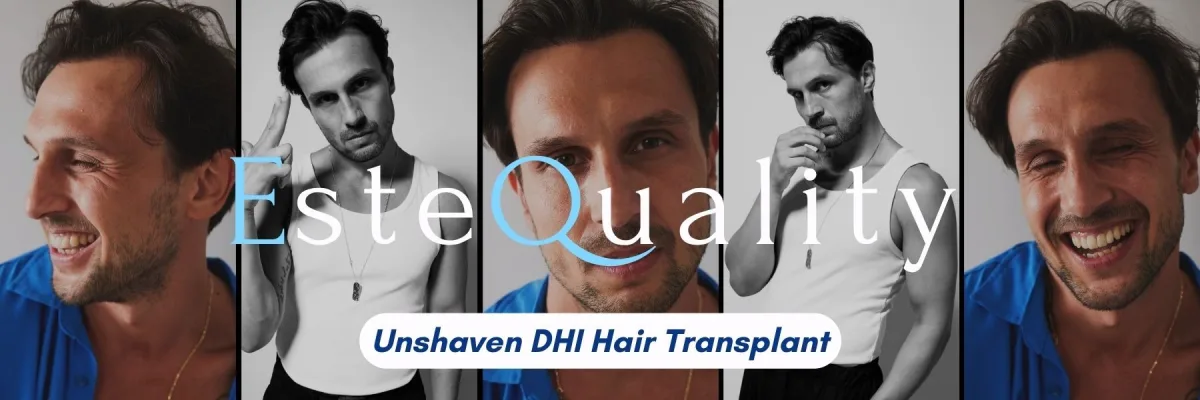 Burak, Schauspieler, Patient mit unrasierter DHI: 2.750 Transplantate, Ergebnis nach 12 Monaten. Professionelle Porträts vom Patienten bereitgestellt