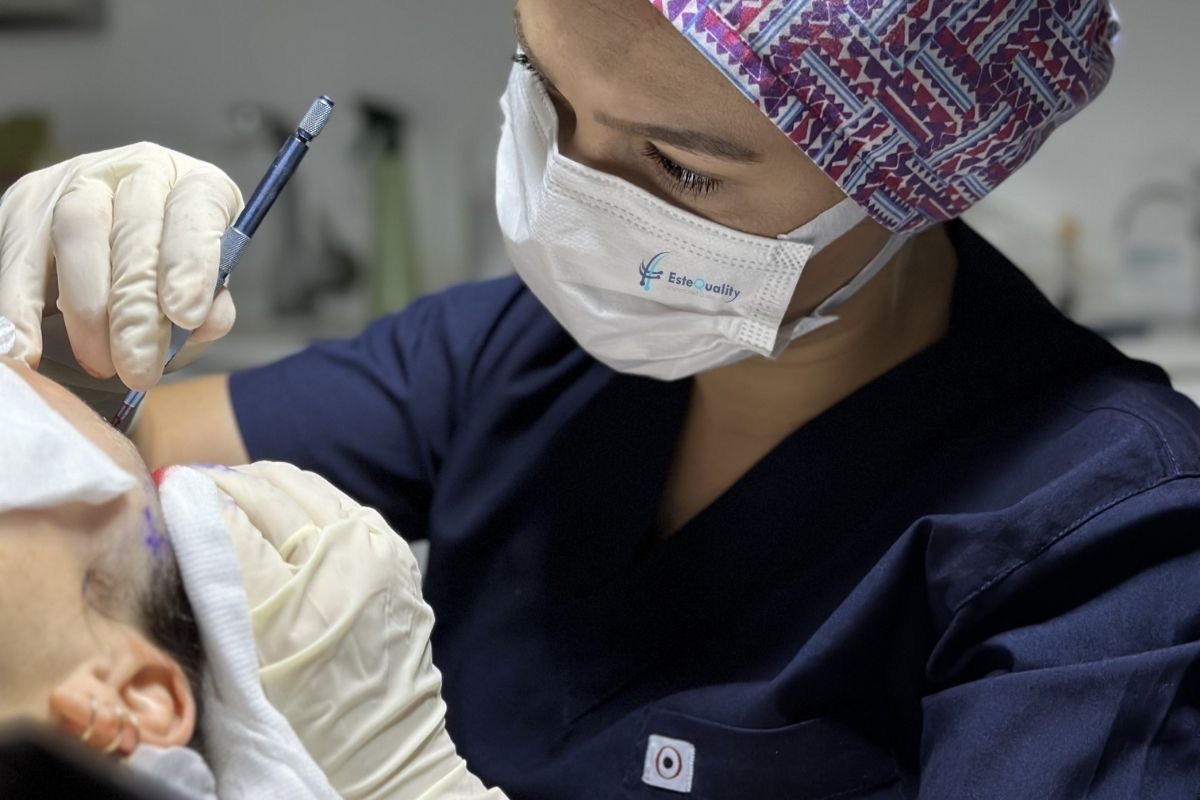 Physician opening recipient channels with a sapphire blade during a hair transplant