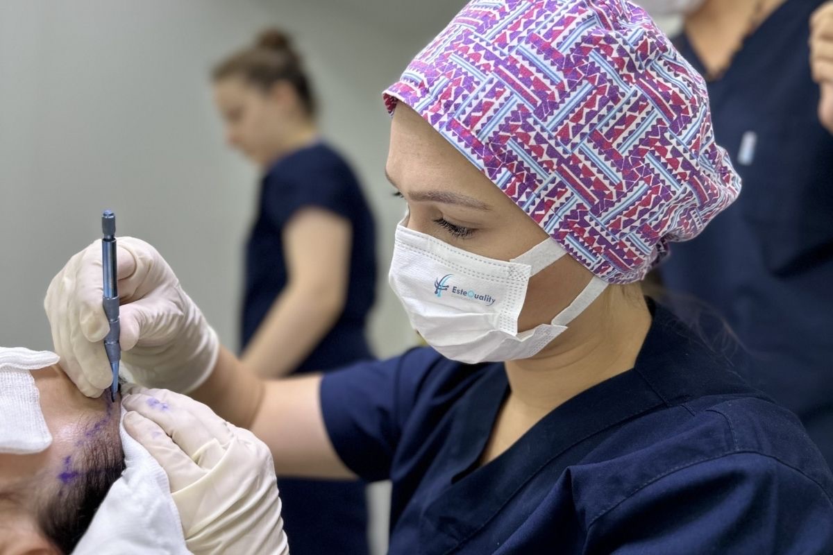 Hair transplant team working in the procedure room during channel opening